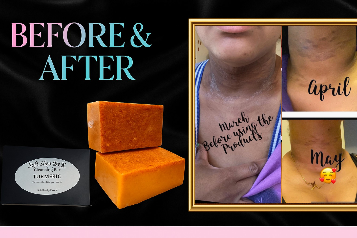 Soft Shea By K Turmeric Cleansing Bar