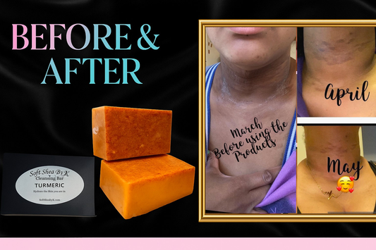 Soft Shea By K Turmeric Cleansing Bar
